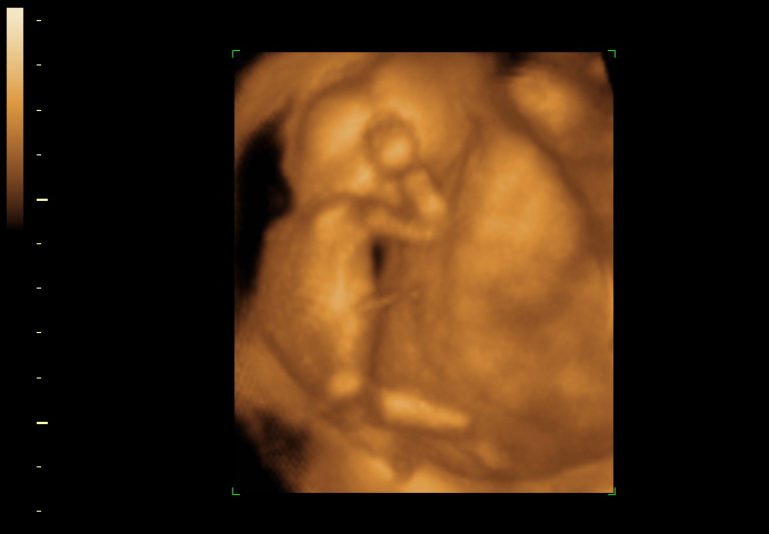 3d sonogram image at 16 weeks