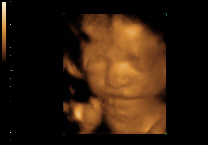 3d sonogram image at 27 weeks