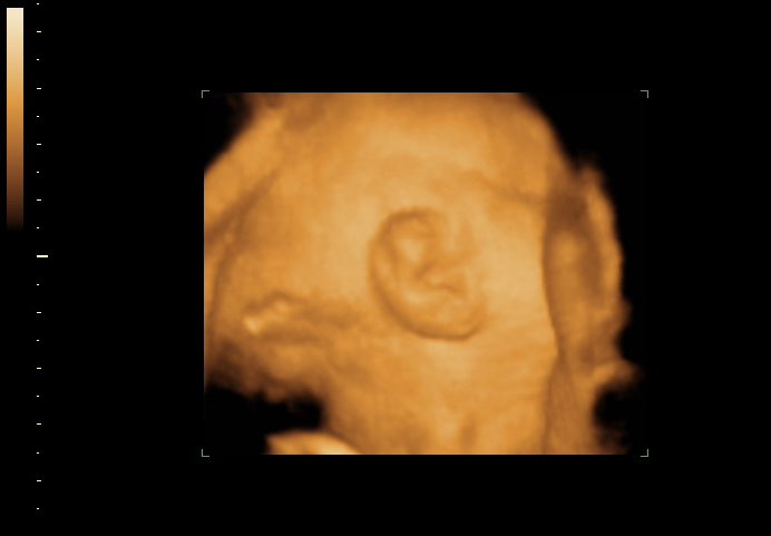 3d sonogram image at 28 weeks