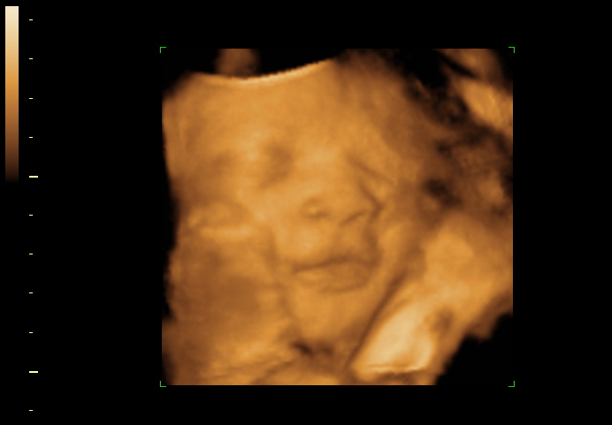 3d sonogram image at 34 weeks
