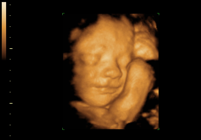 30 weeks 3d ultrasound